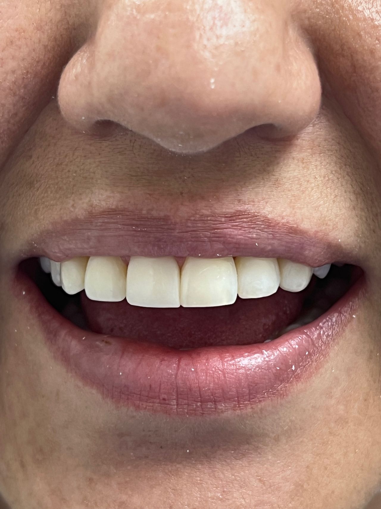 Melissa Vargas Castellanos-10