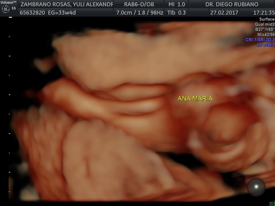 Diego Giovanni Rubiano Zarate-5