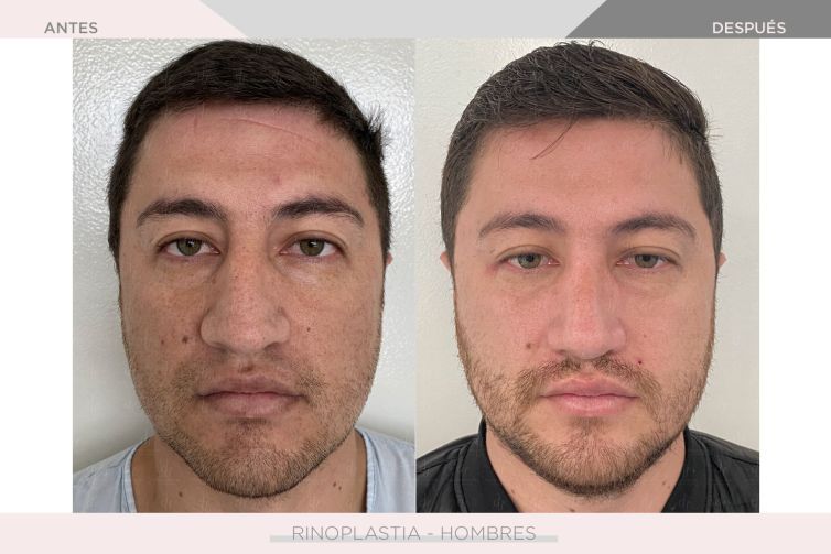 Denise Ventura Perez-14