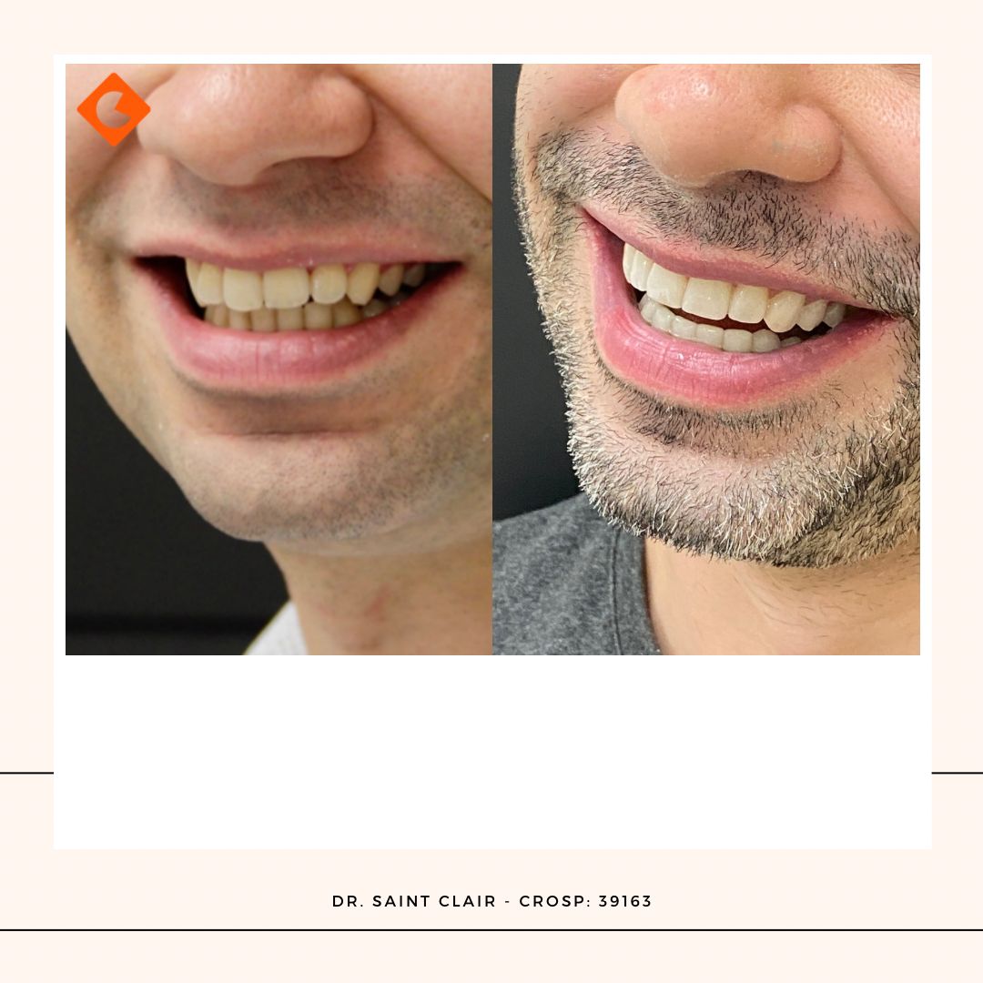 Saint Clair Barbosa Netto-19