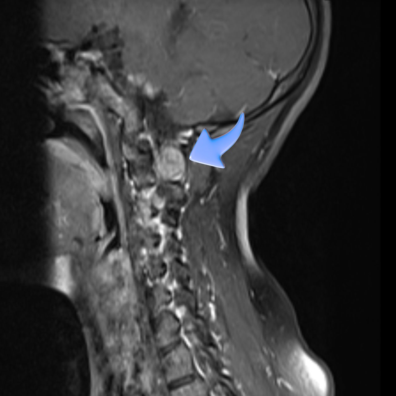 David Tafur Muñoz-1798