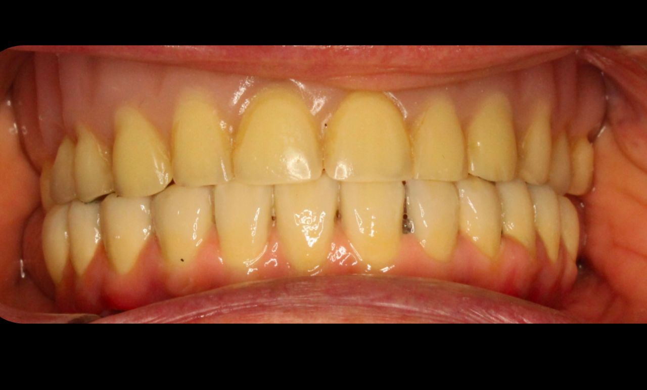 Juan Carlos Gac Pasten-13