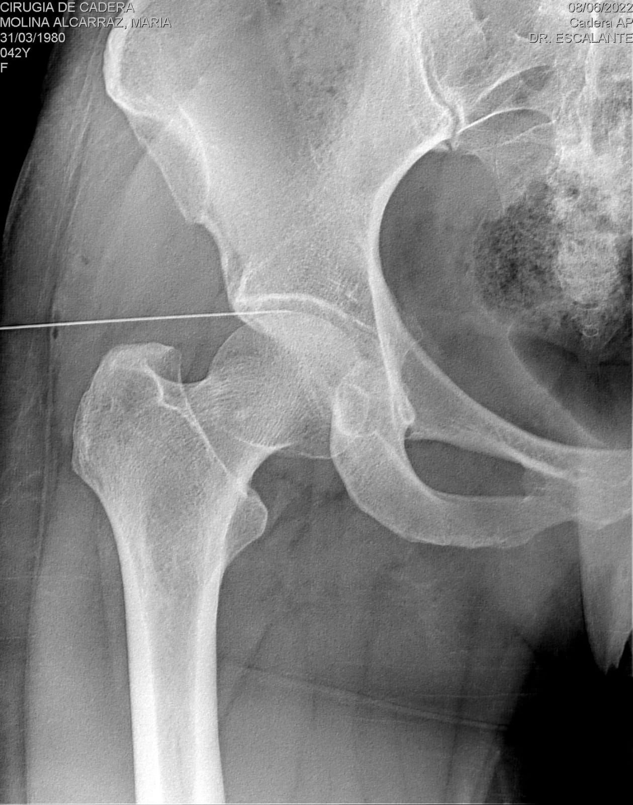 Carlos Escalante Saavedra-16