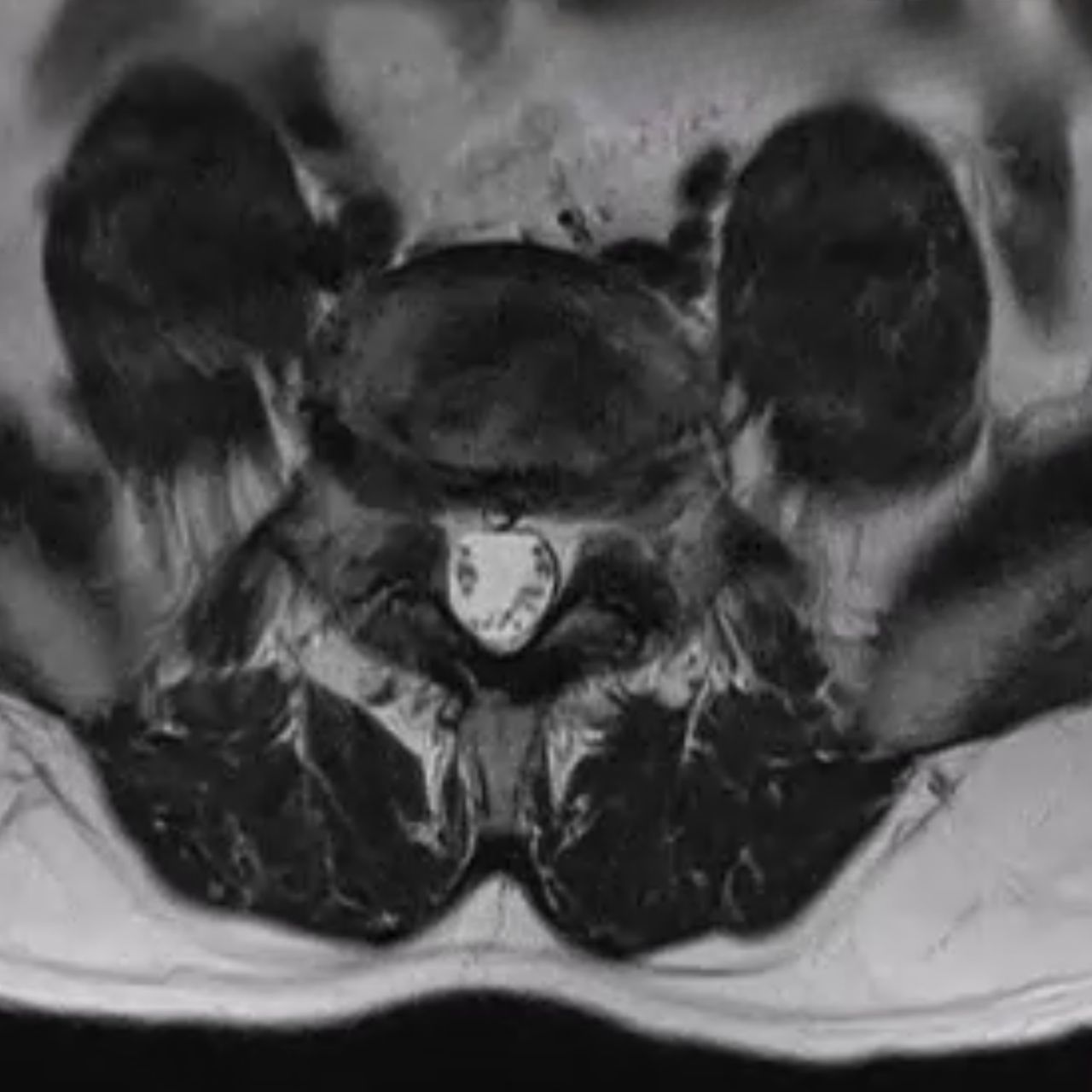 David Tafur Muñoz-1473