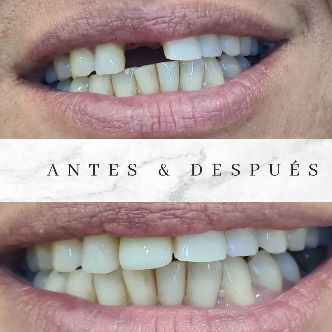 Cristian Manuel Robles Peña-6