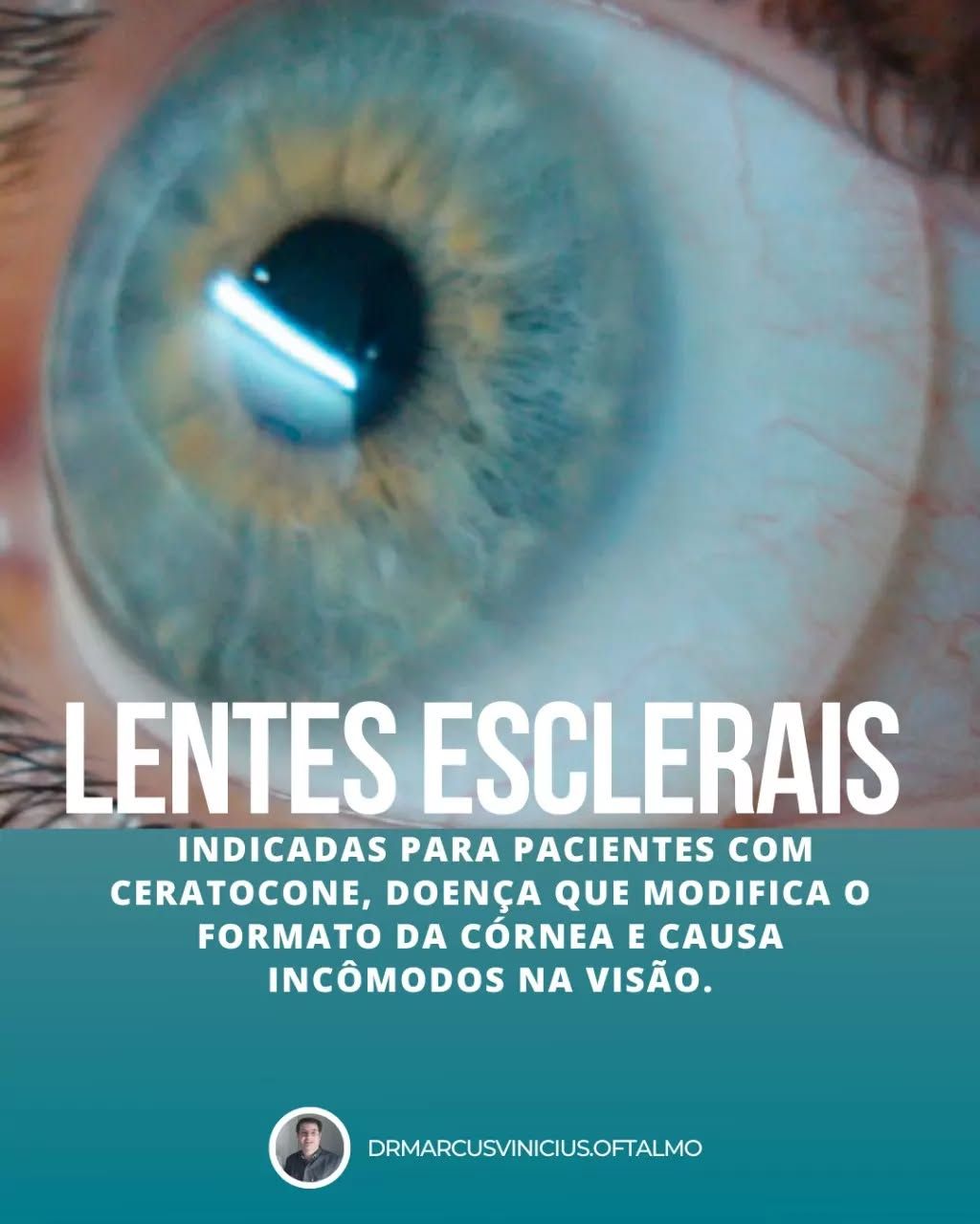 Marcus Vinicius De Oliveira Freitas-7