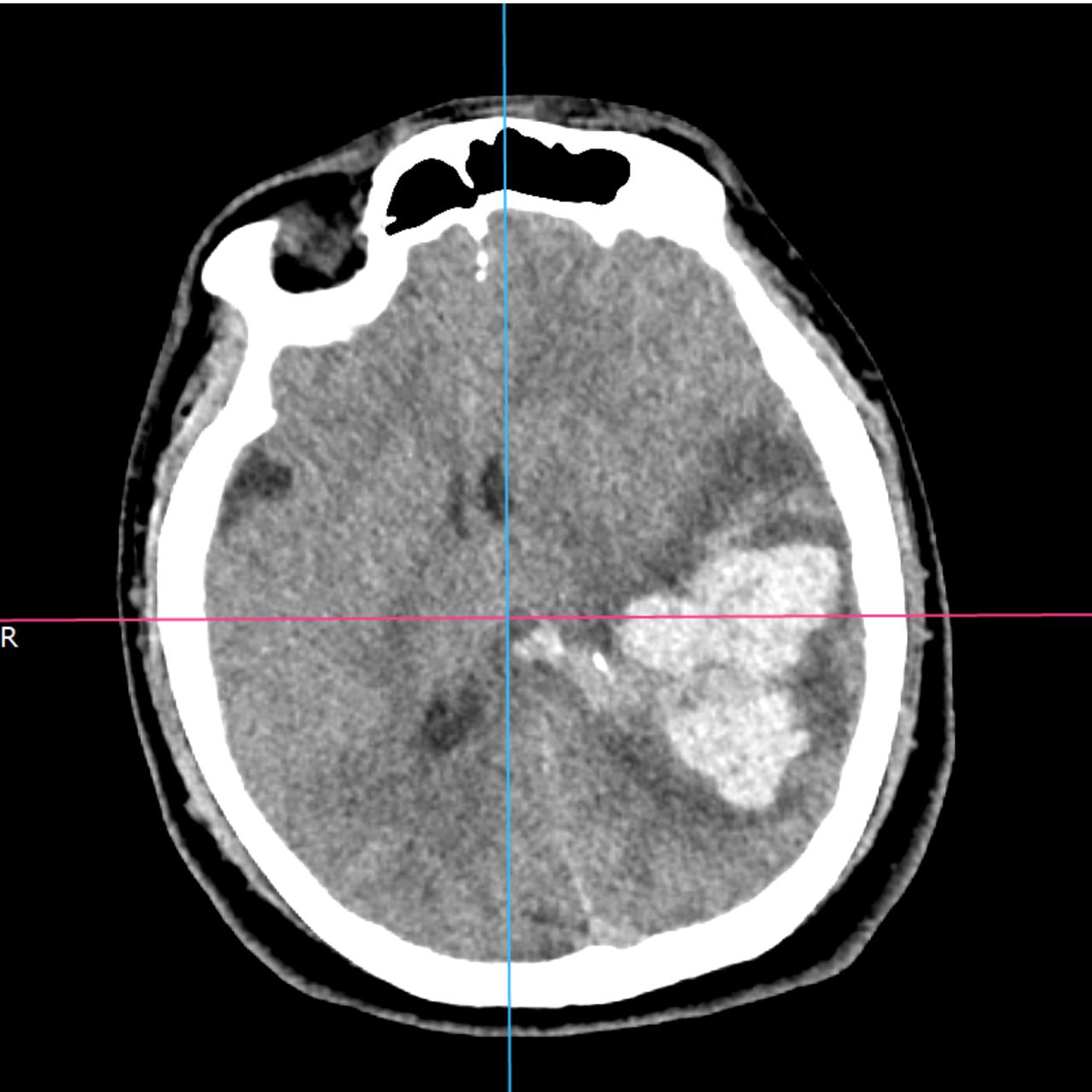 David Tafur Muñoz-1917