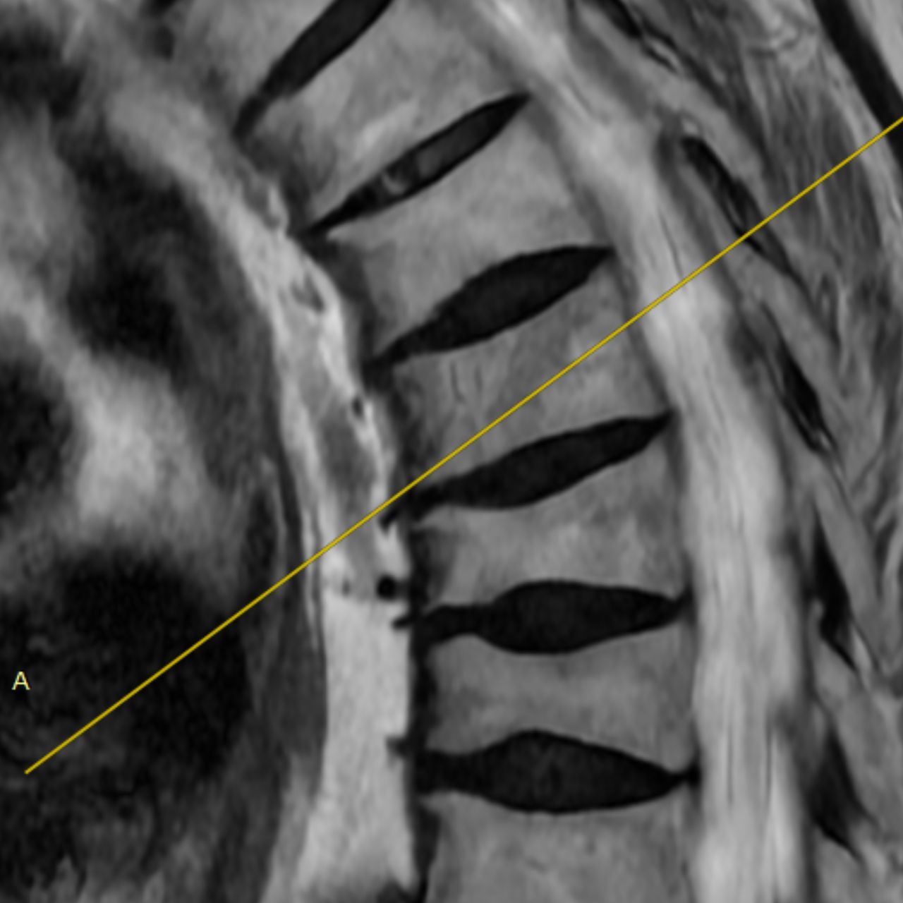 David Tafur Muñoz-1502