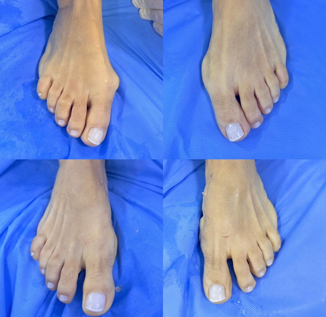 Leandro Jacomassi Machado-11