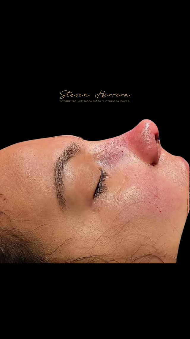 Steven Herrera-4