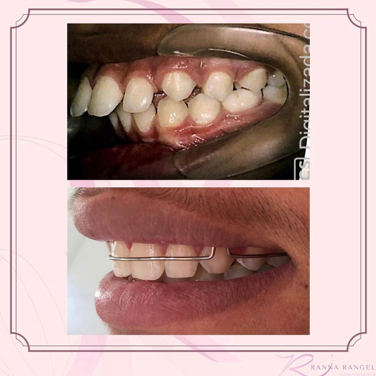 Ranna Rangel Saraiva-7