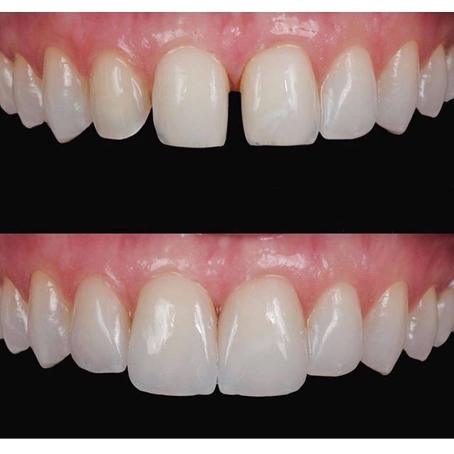 Leandro Ponte Dias-14