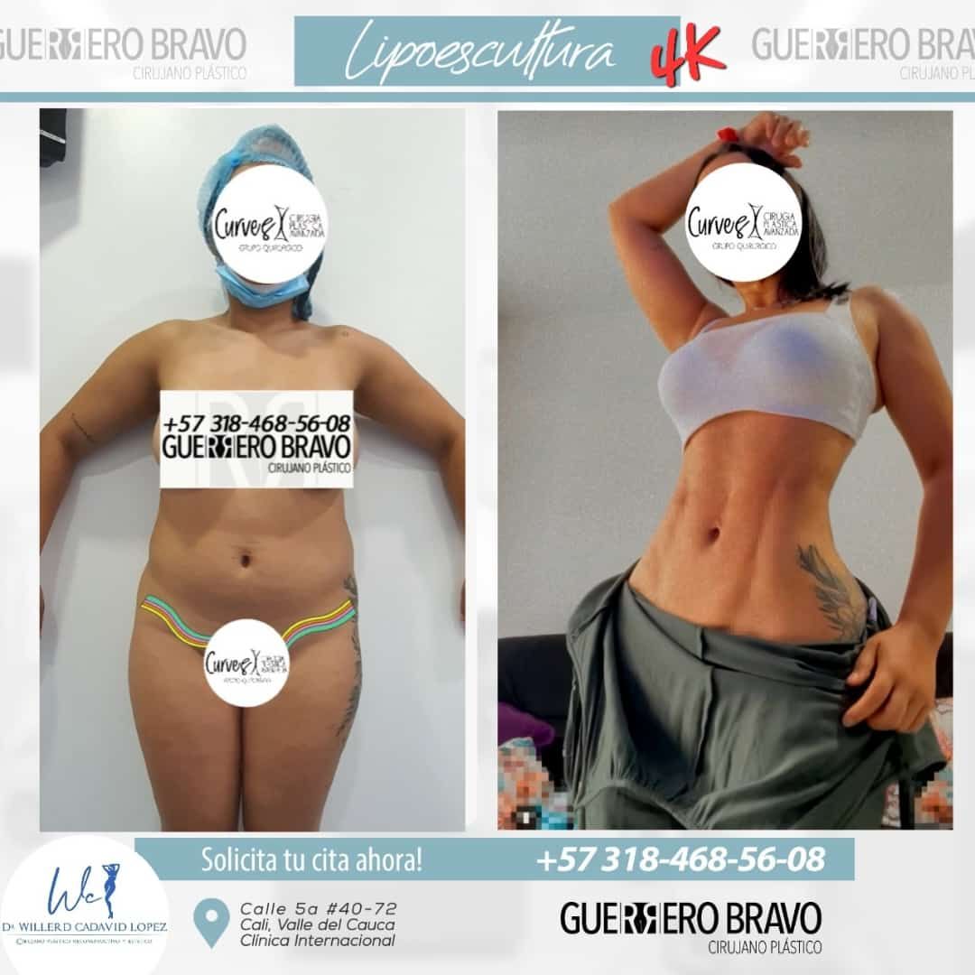 Camilo Guerrero Bravo-31