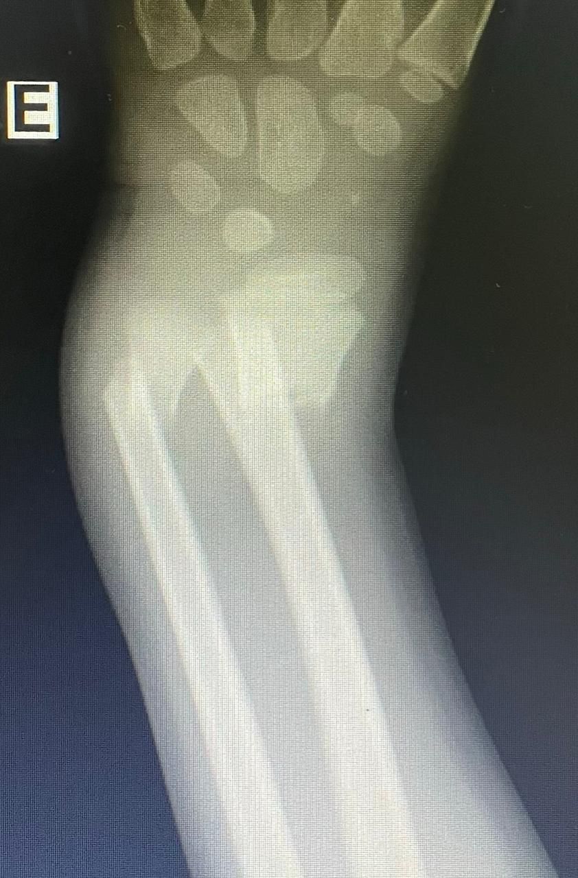 Jônatas Laurindo Giacomini-21