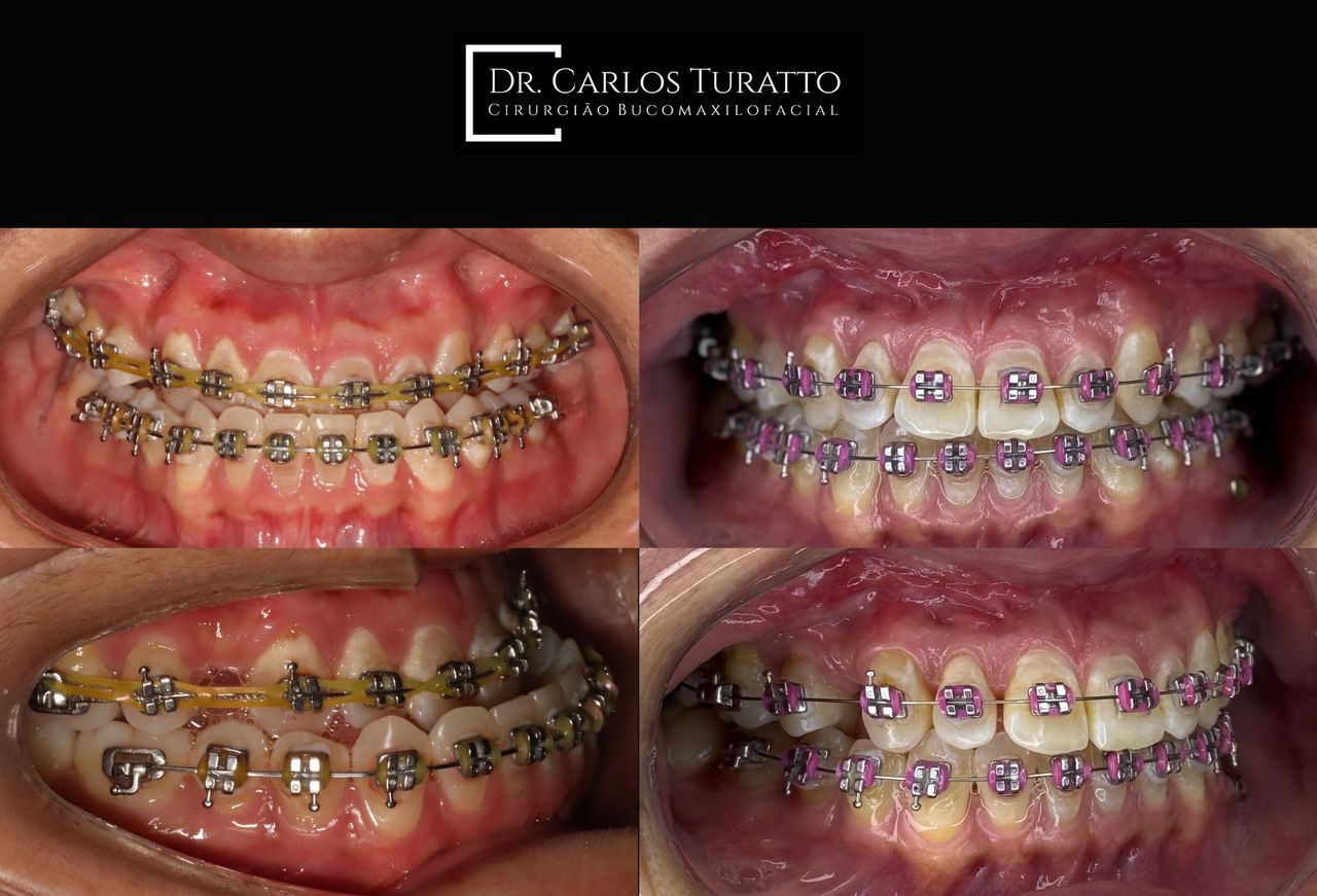 Carlos Turatto-5