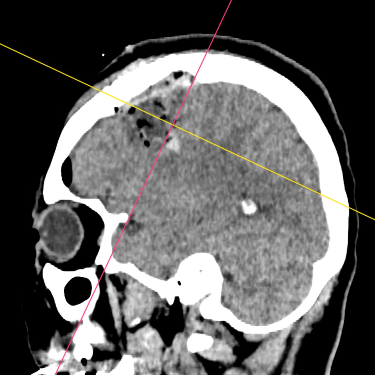 David Tafur Muñoz-1694