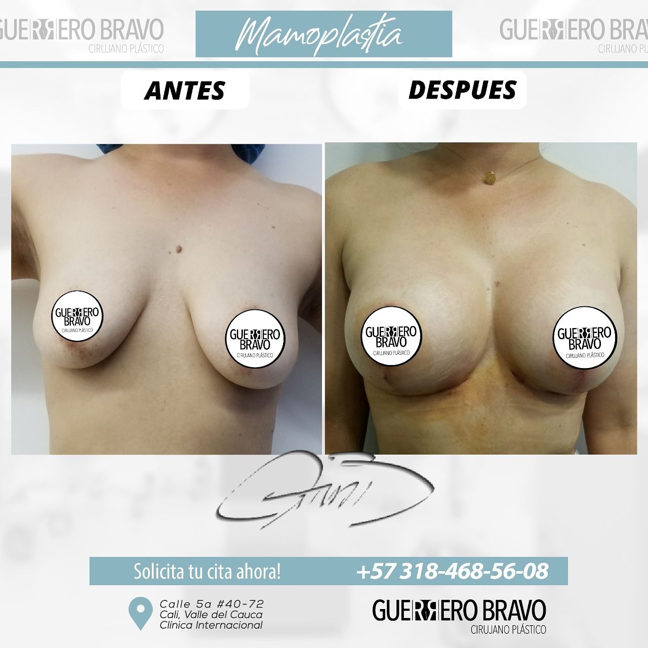 Camilo Guerrero Bravo-100