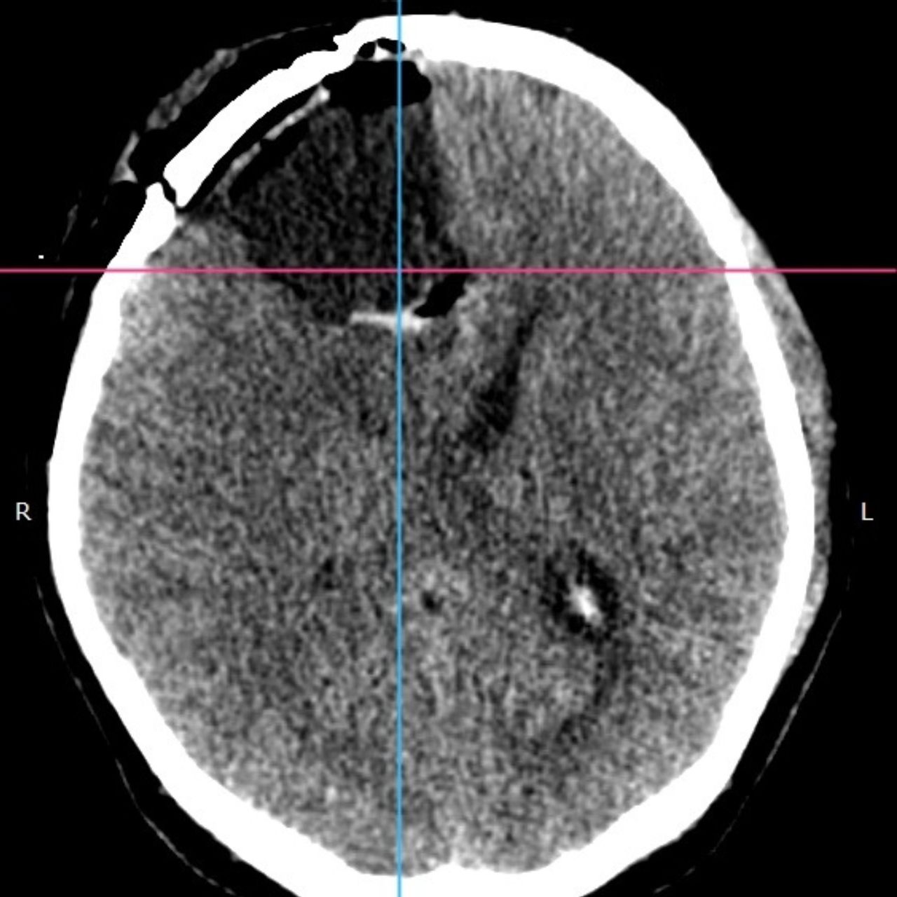 David Tafur Muñoz-1390