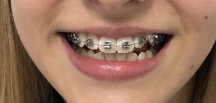 Celia Visentainer Dela Libera-2