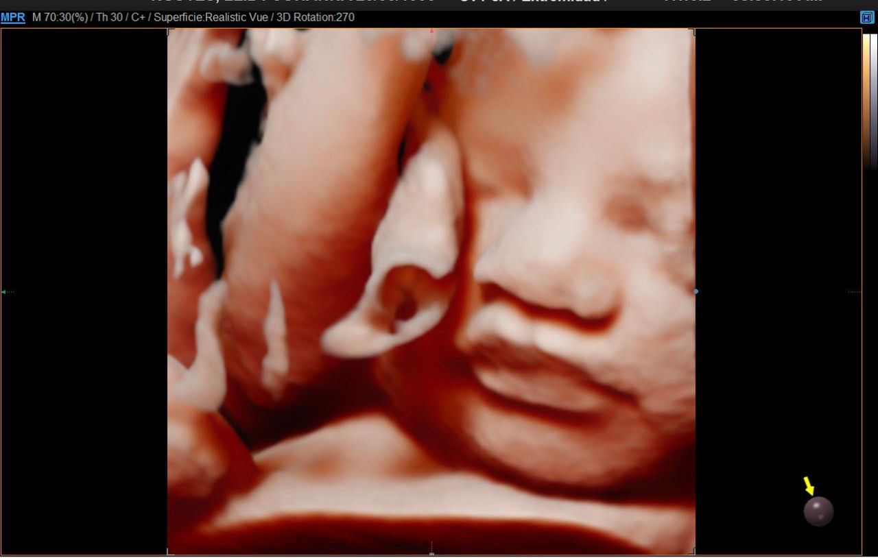 Jonh Harold Alvis Botello-3