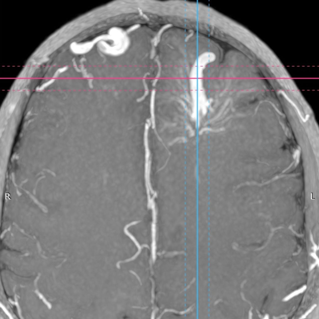 David Tafur Muñoz-1379