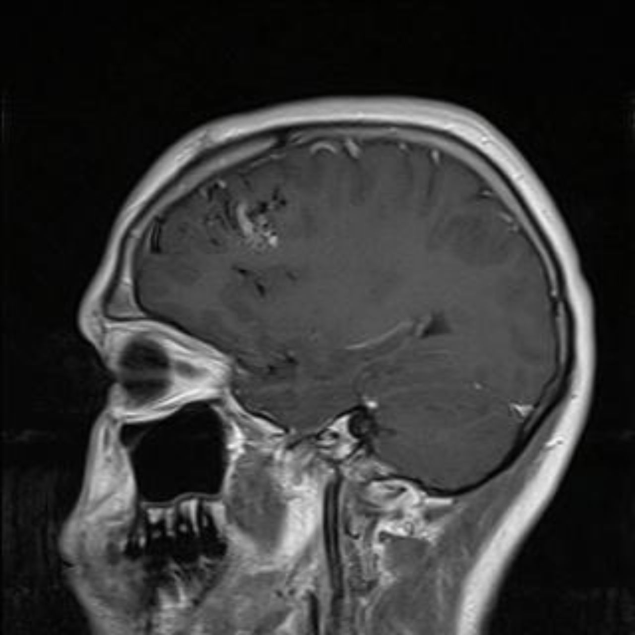 David Tafur Muñoz-1940