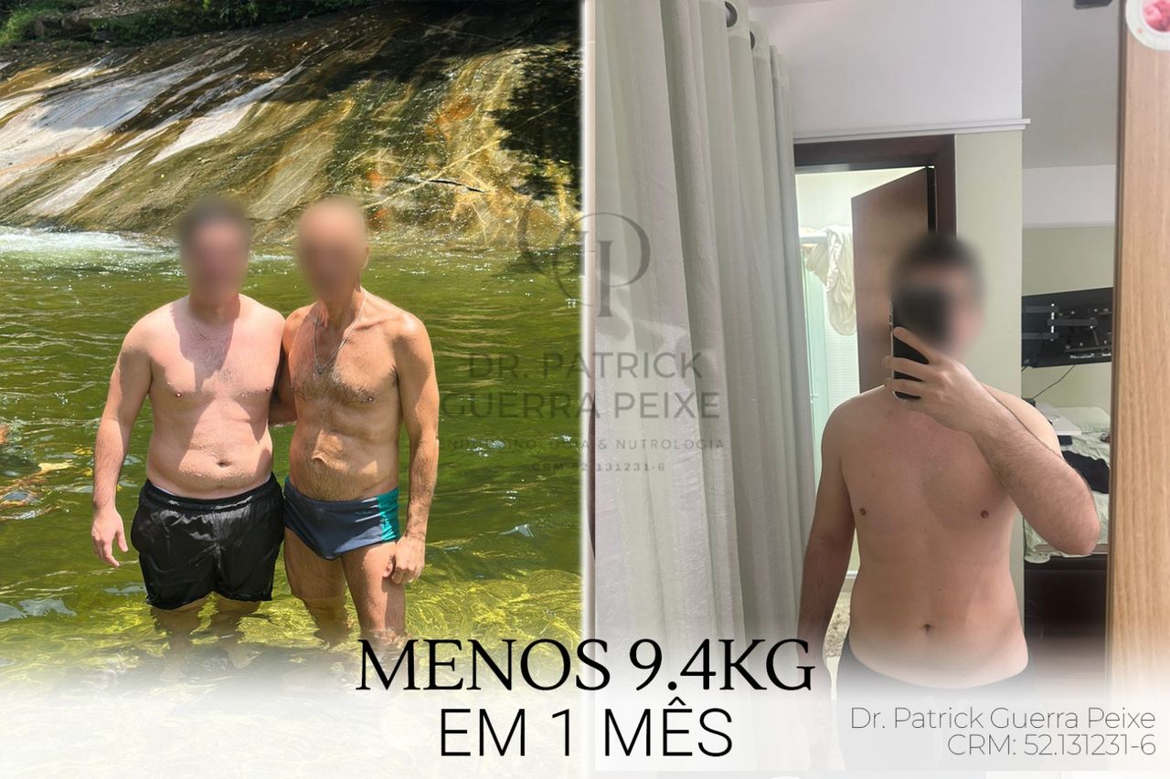 Patrick Guerra Peixe-3