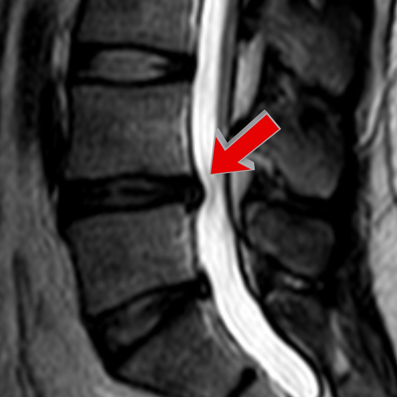 David Tafur Muñoz-2243