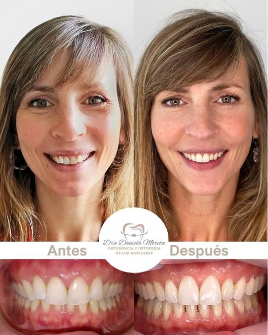 Myriam Daniela Moreta-0