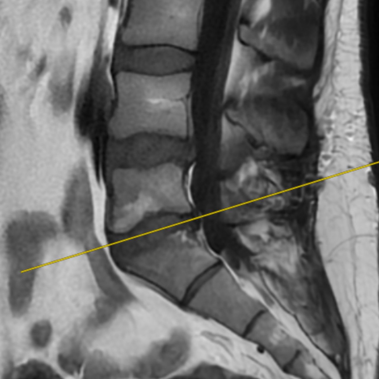 David Tafur Muñoz-1544