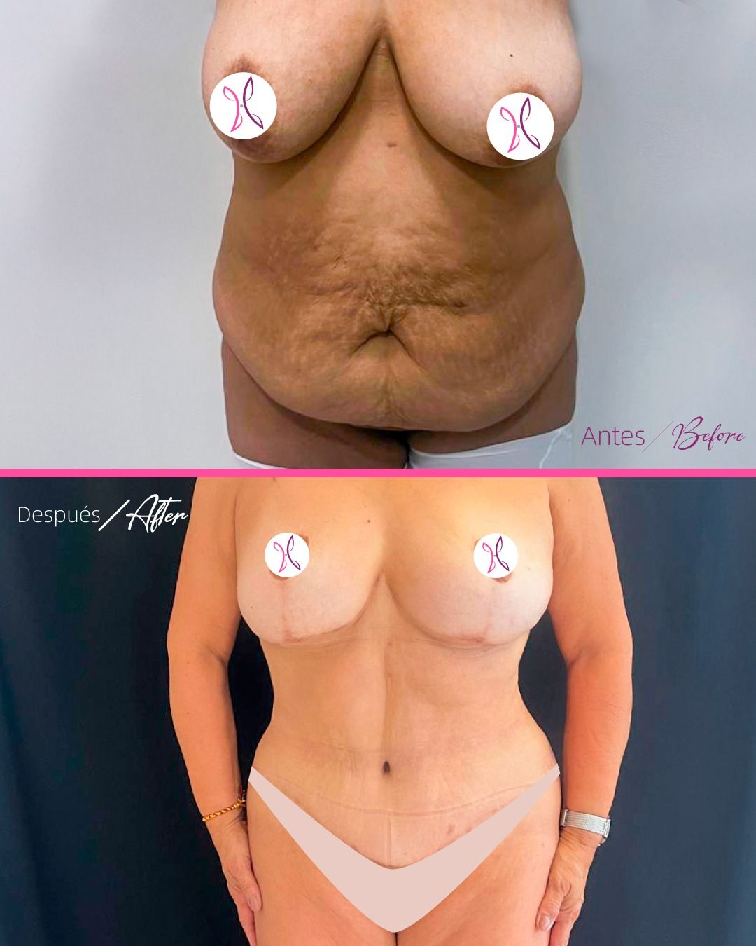 Patricia Betancourt-2