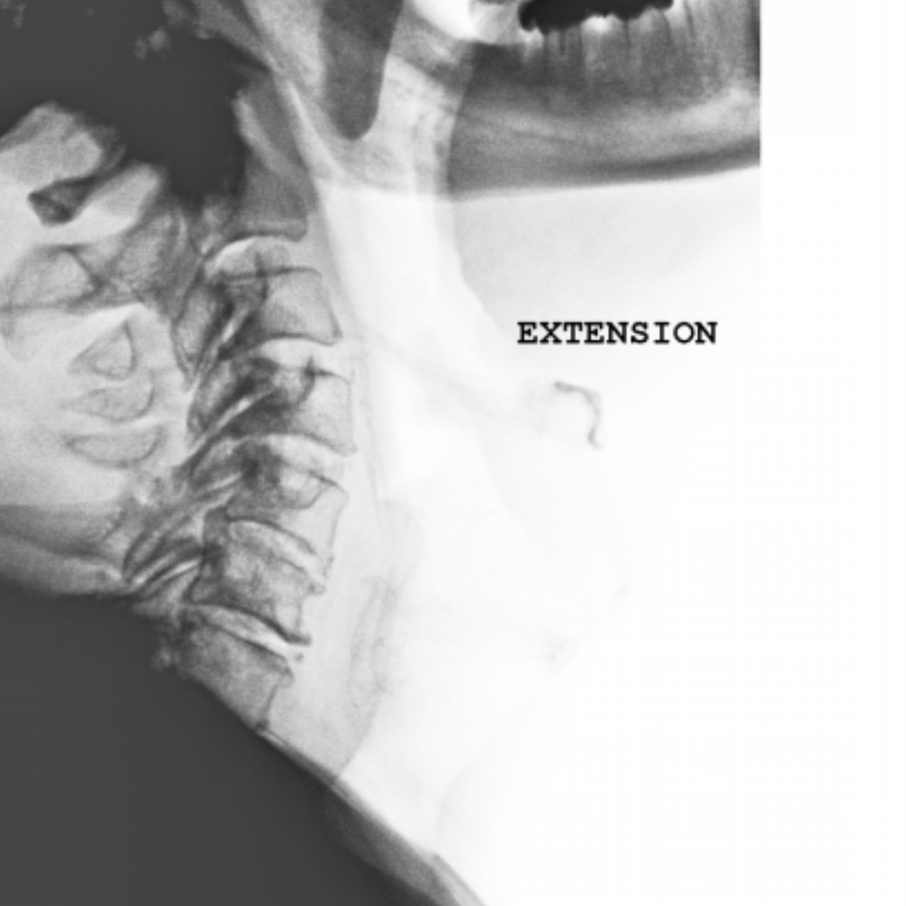 David Tafur Muñoz-2077