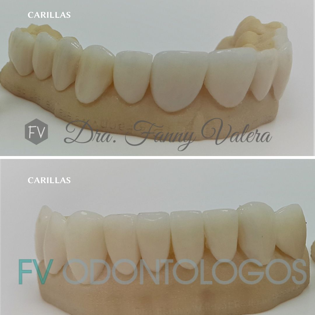 Fanny Valera Velásquez-103