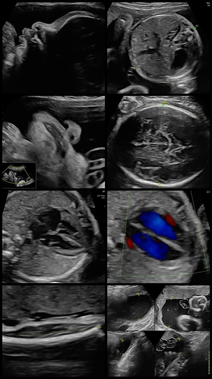 Jessica Paola Barón Avendaño-2