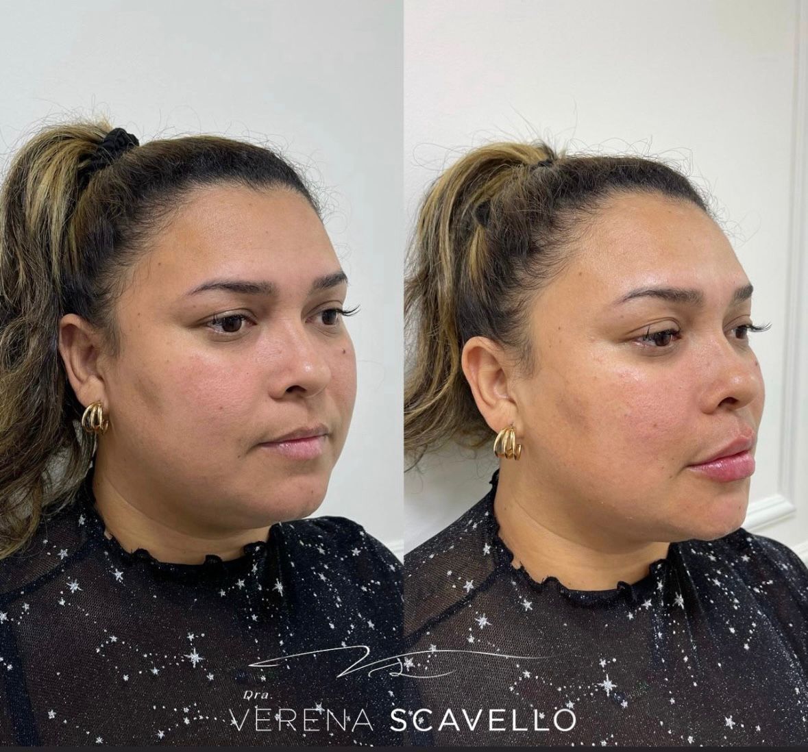 Verena Scavello-11