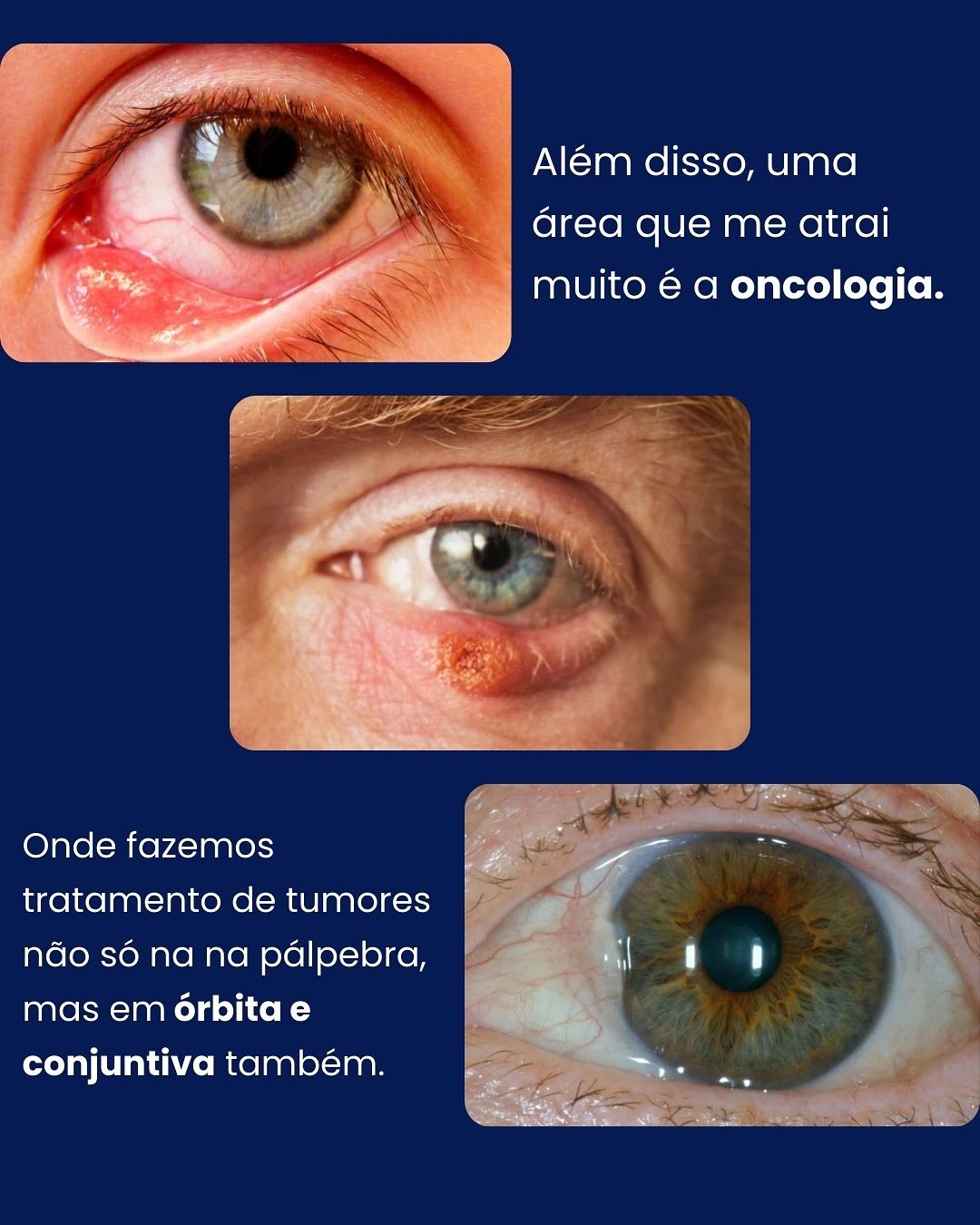 Araê De Oliveira-10