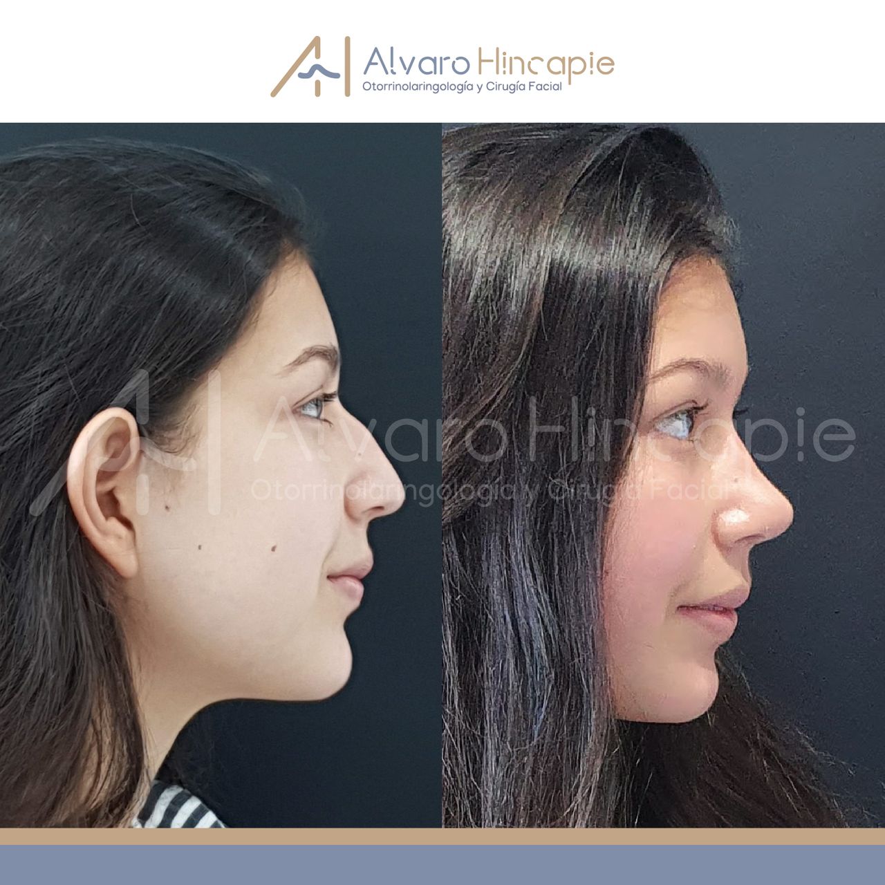 Alvaro Hincapie Quintero-3