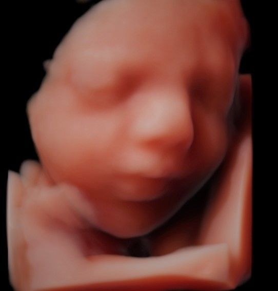 Charles Schwantz De Lima-5