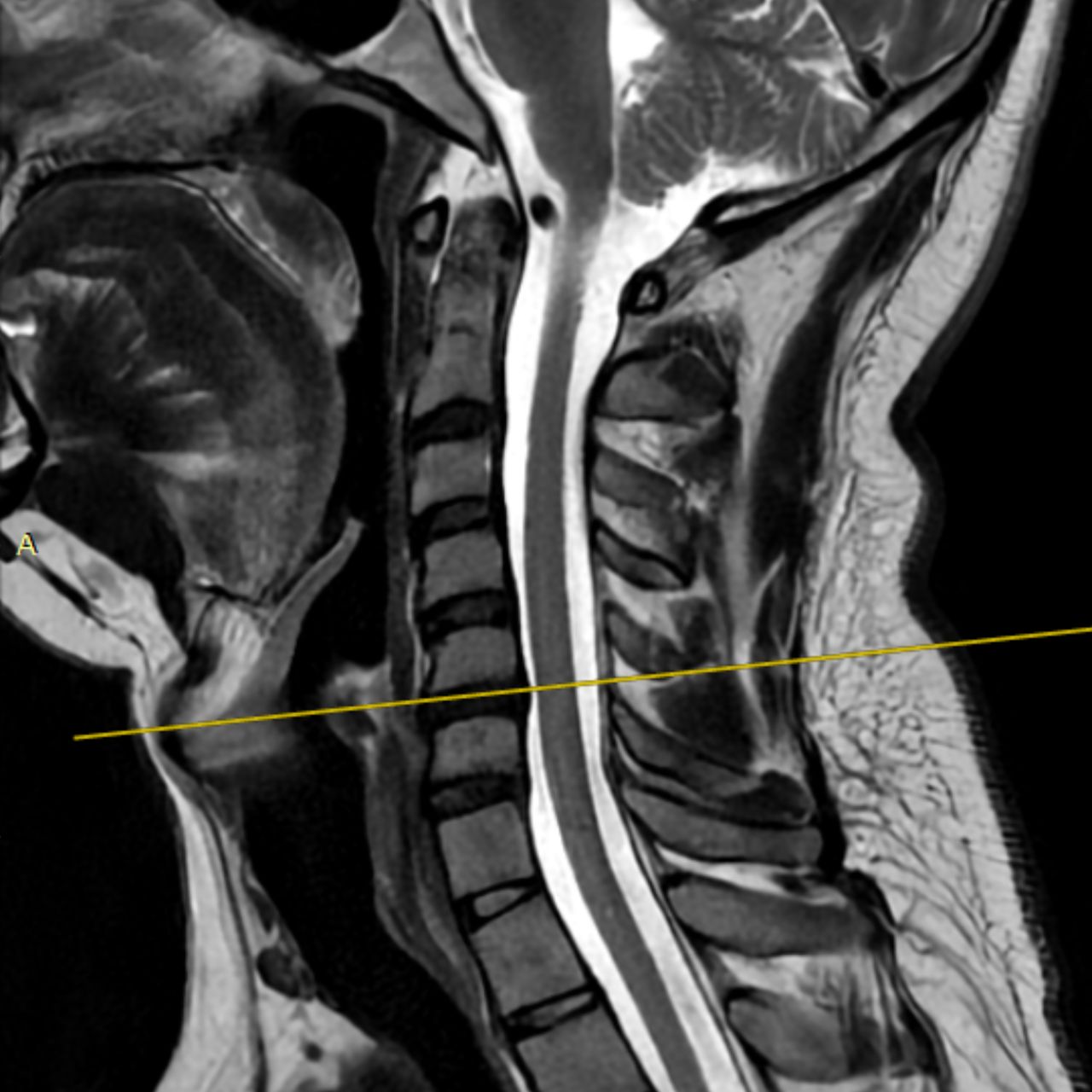 David Tafur Muñoz-1421