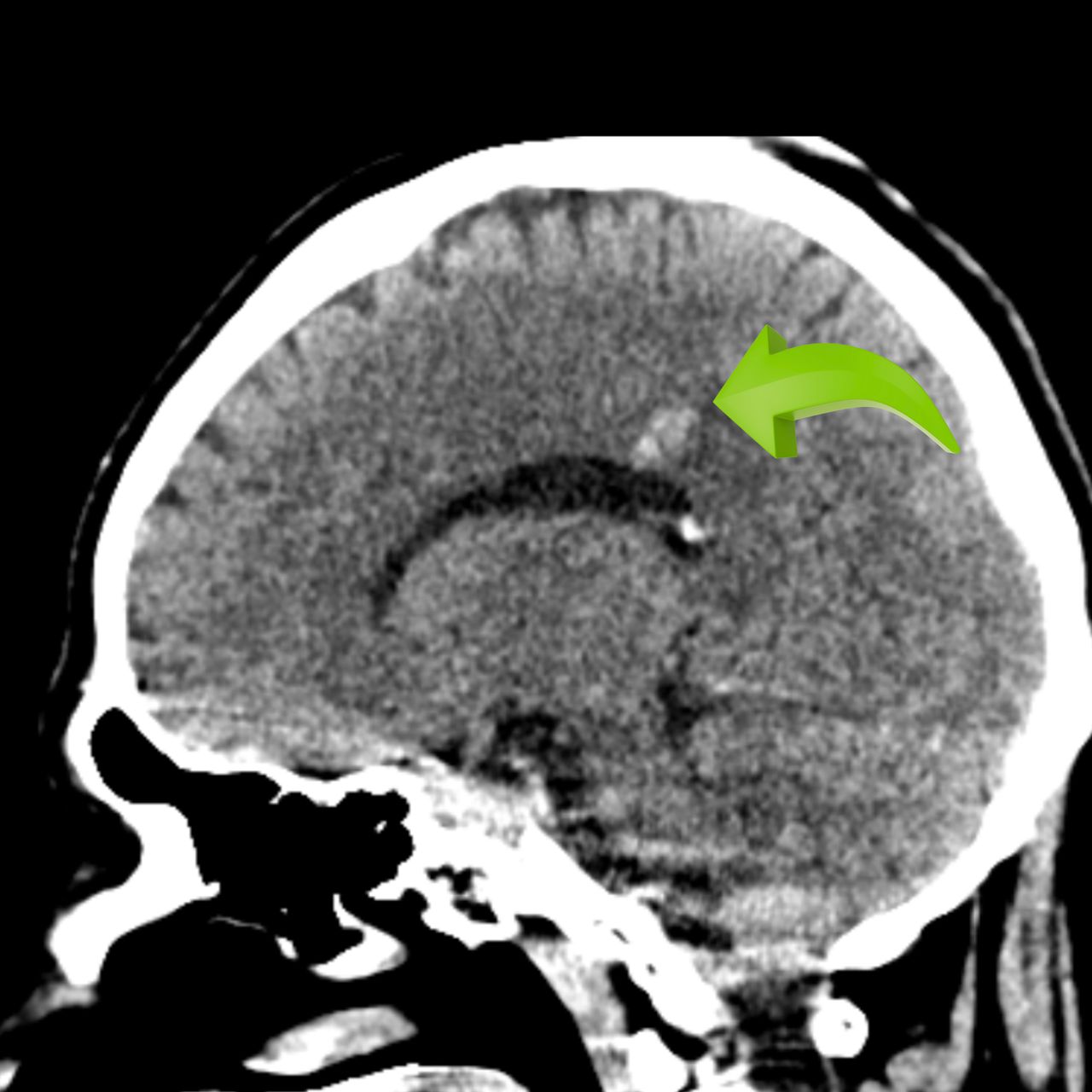 David Tafur Muñoz-1616