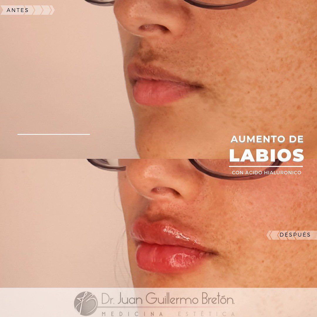 Juan Guillermo Bretón Franco-13