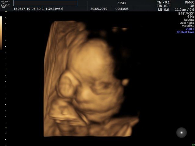 Raul Javier Banderas Pumarino-22