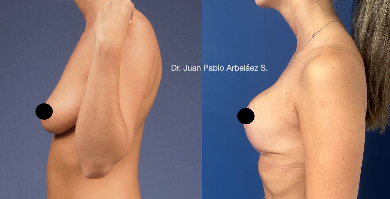 Juan Pablo Arbeláez Sierra-4