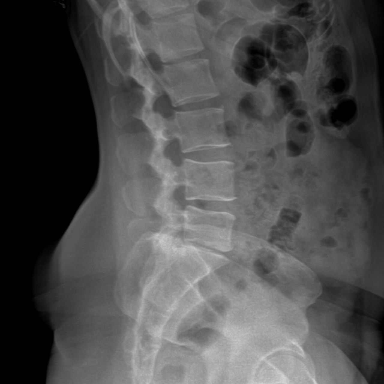 David Tafur Muñoz-2458