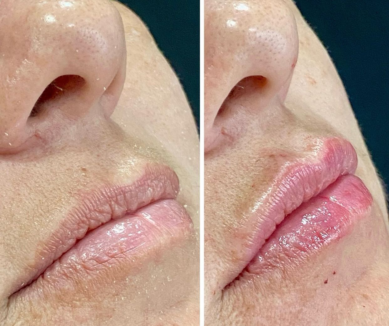 Kellen Dantas Marinho-7