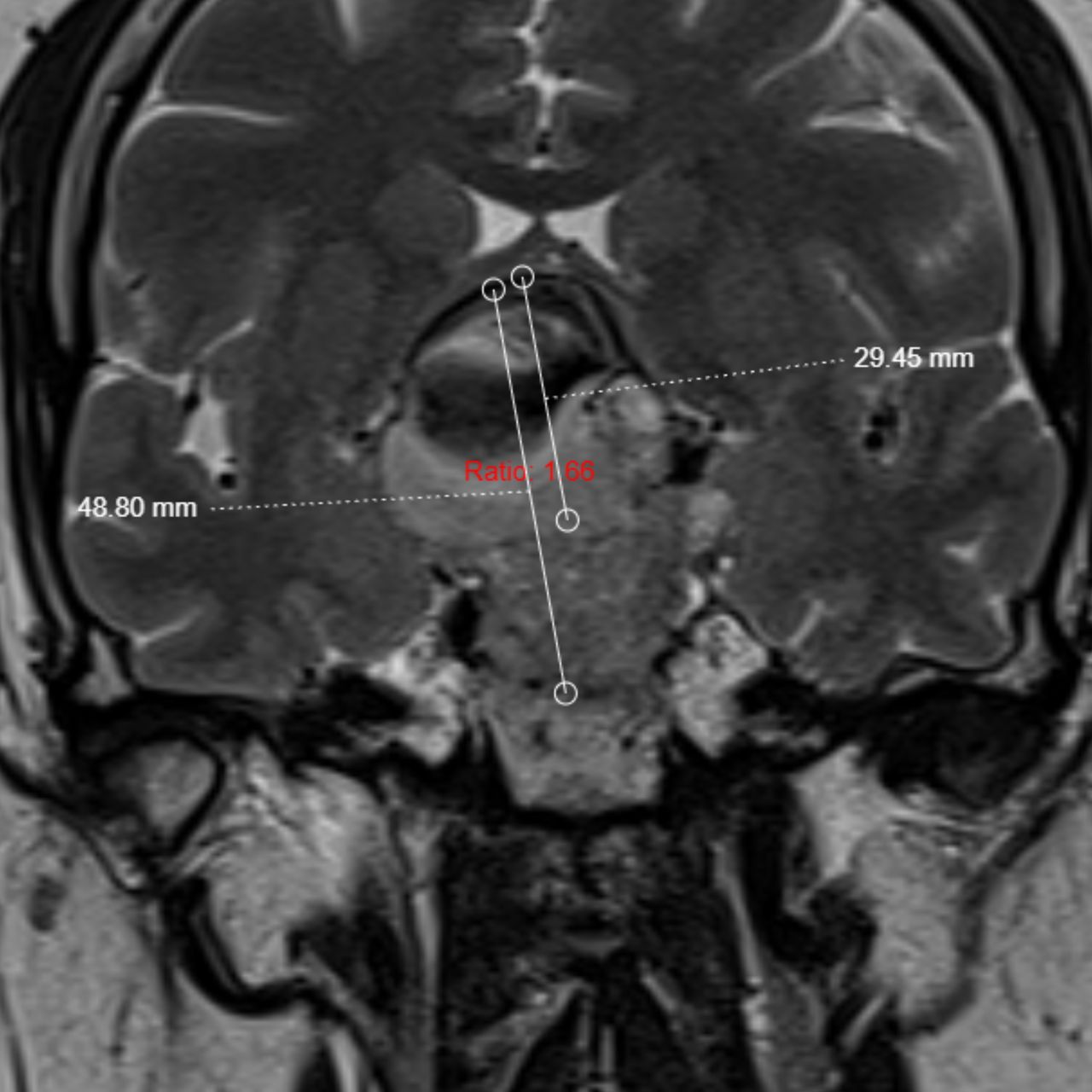 David Tafur Muñoz-1478