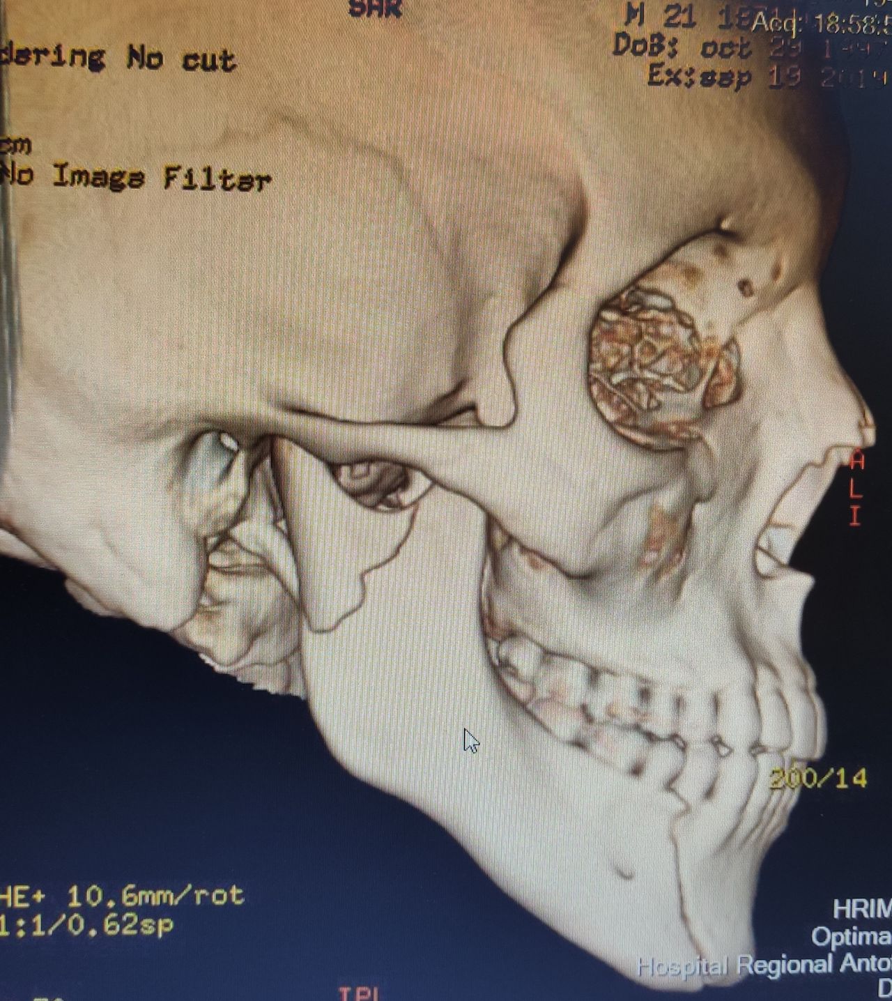 Fernando Germain Edwards-2