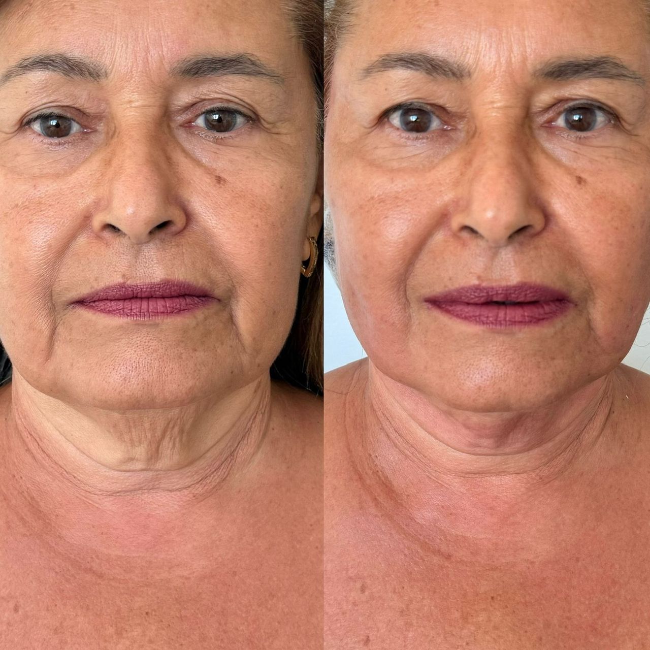 Telma Viana Martins-22