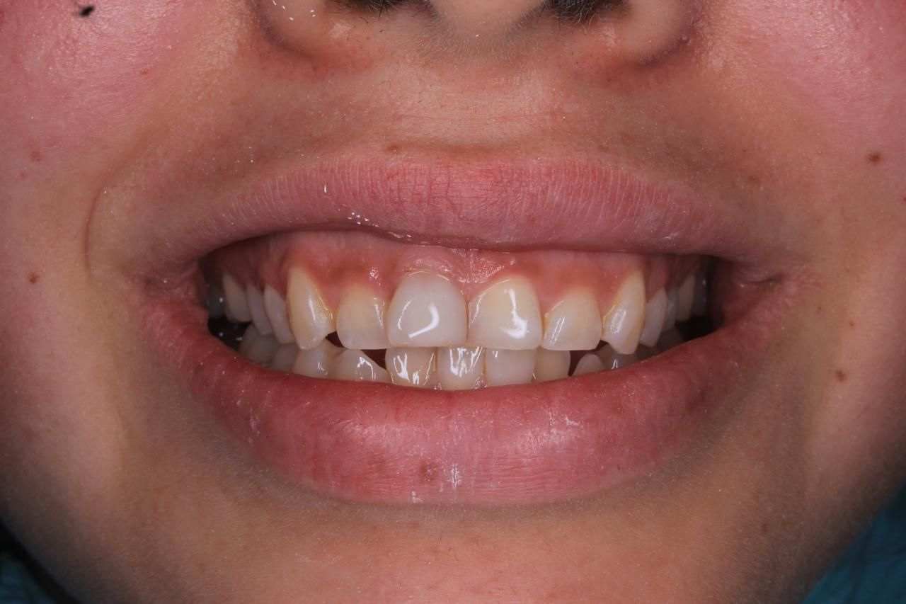 Francisco Bahamonde-7