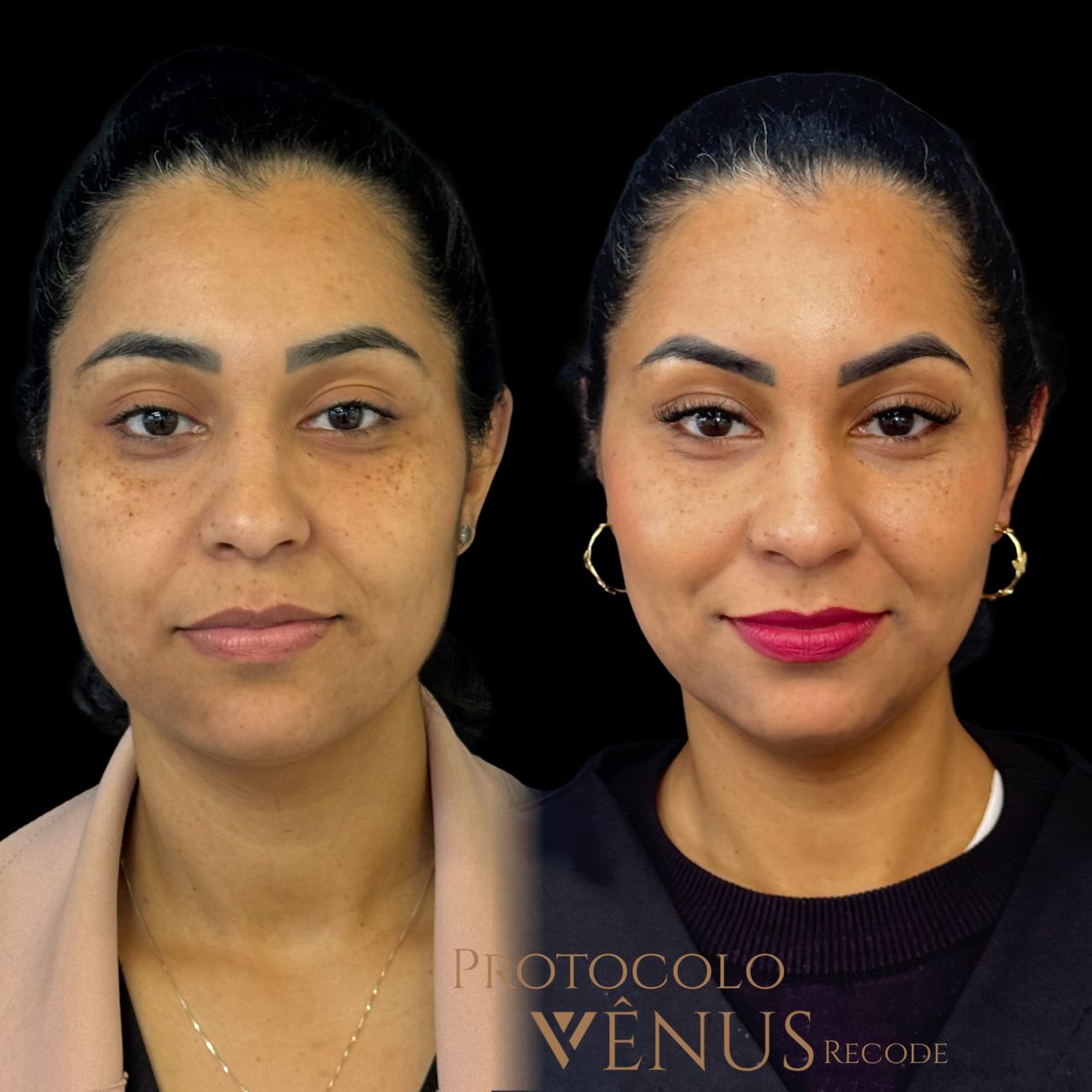 Gisele De Carvalho Versannio-18